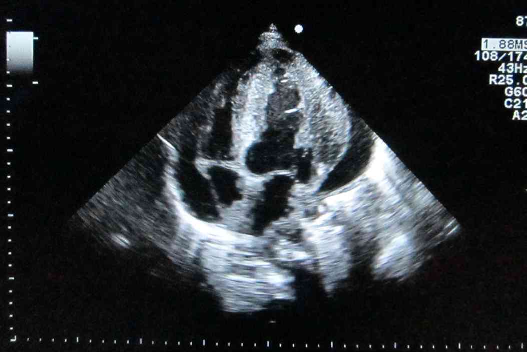 Figure 1 F1